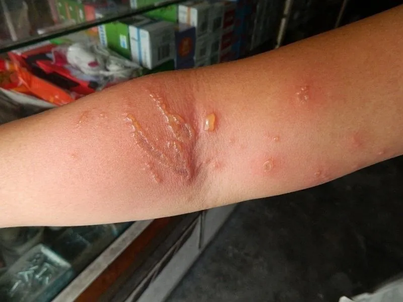Cách phòng tránh 6 nguy cơ tiềm tàng khi đi du lịch biển Cách phòng tránh 6 nguy cơ tiềm tàng khi đi du lịch biển